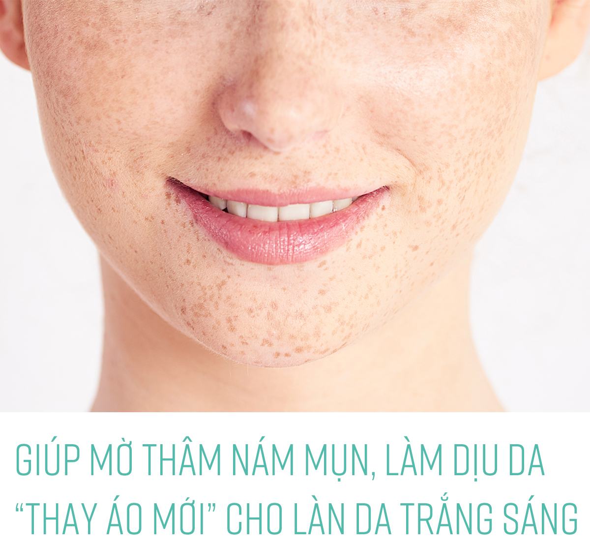 Kem dưỡng ẩm mờ nám tàn nhang, trắng sáng, cấp ẩm, làm dịu da nhạy cảm tinh chất rau má Anti-Melesma Centella Cream