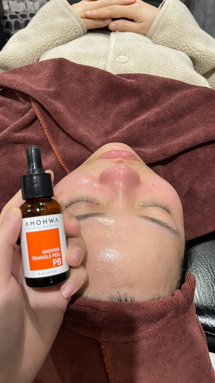 Ahohaw Triangle Peel da PB - Dành cho da mụn - 80ml