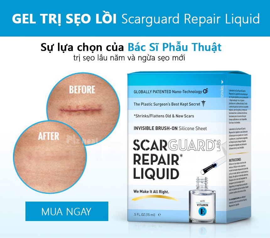 Gel Trị Sẹo Lồi Scarguard Repair Liquid 15ml (Scarguard MD)