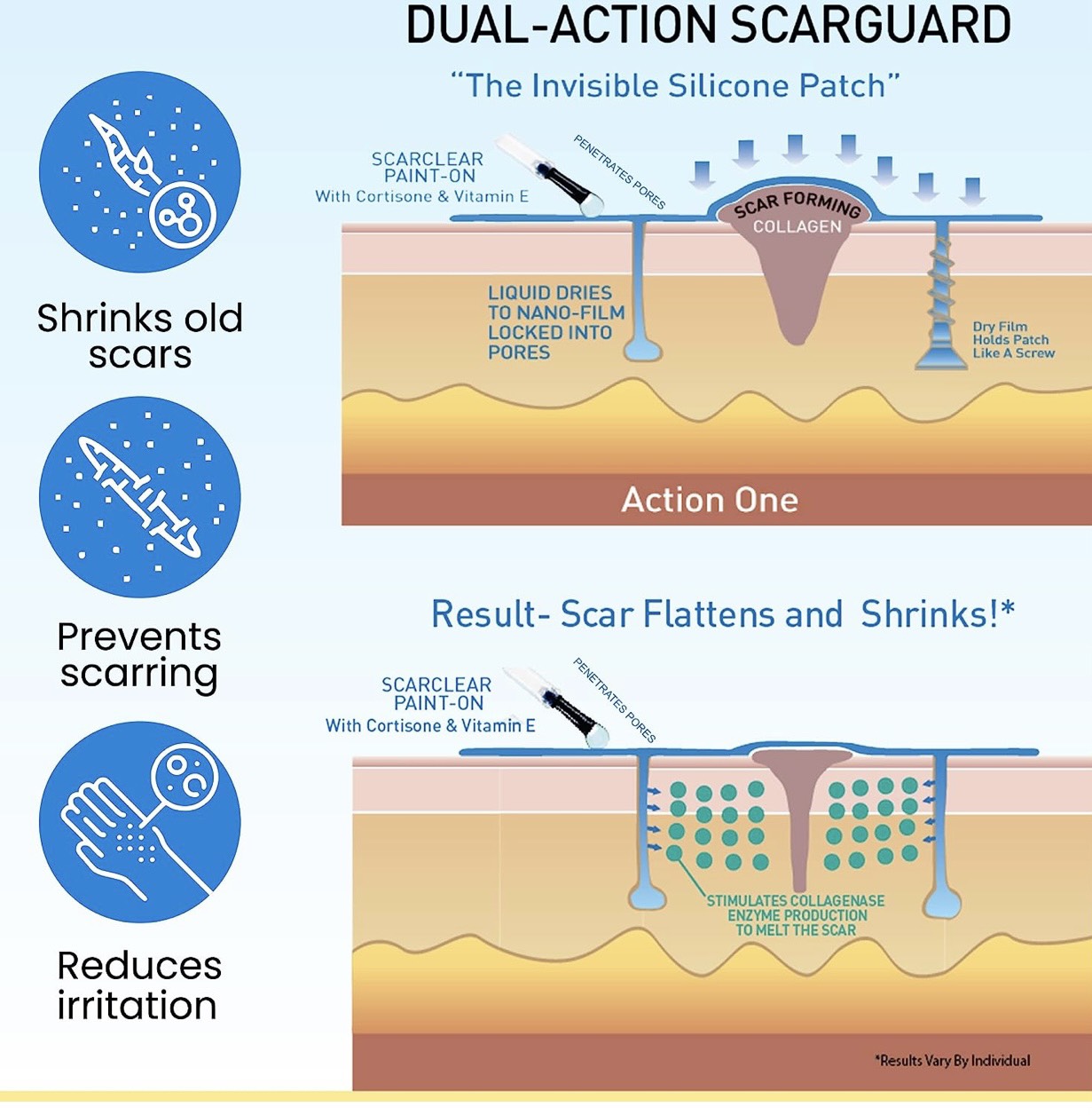 Gel Trị Sẹo Lồi Scarguard Repair Liquid 15ml (Scarguard MD)