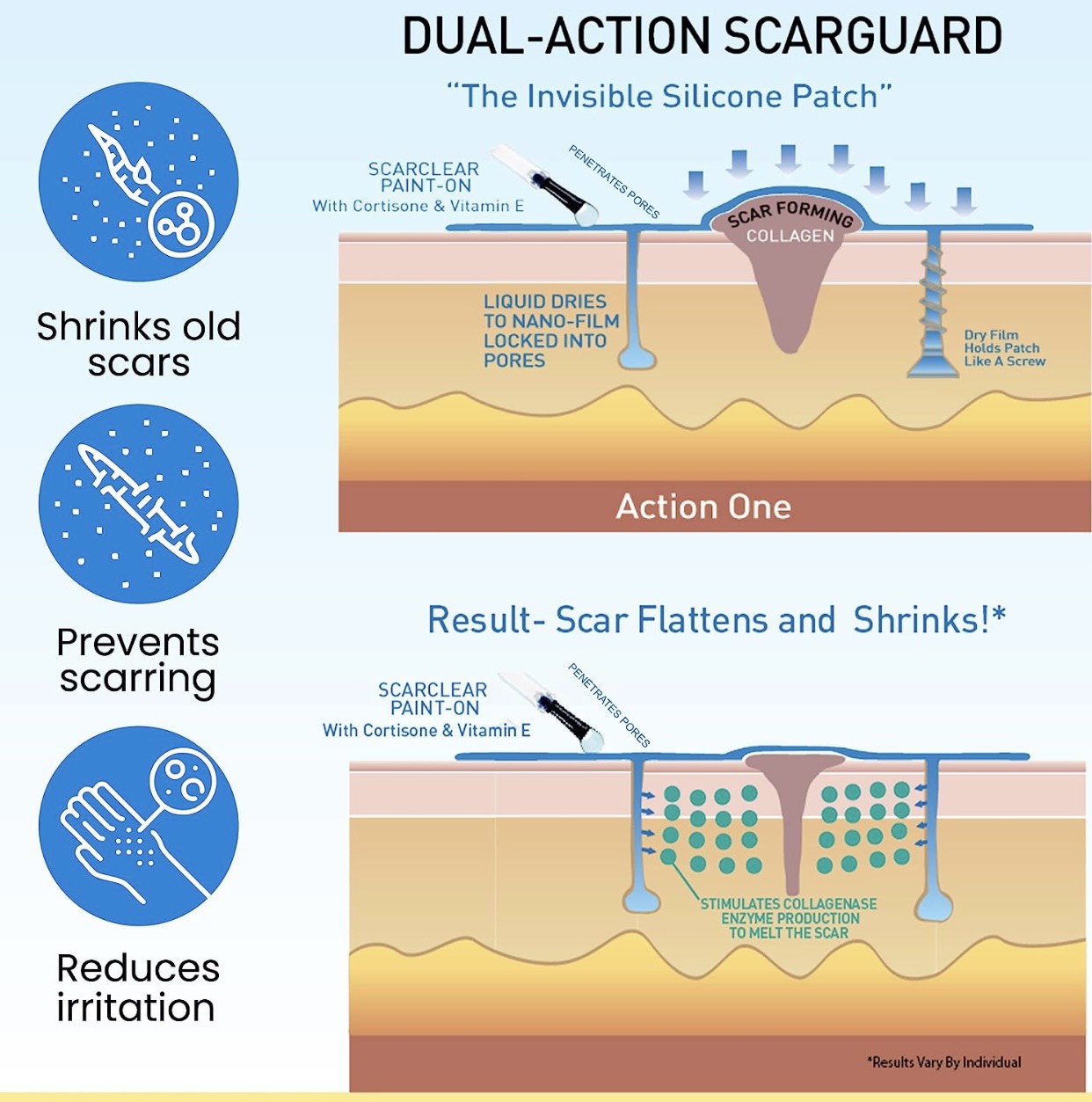 Gel Trị Sẹo Lồi Scarguard Repair Liquid 15ml (Scarguard MD)