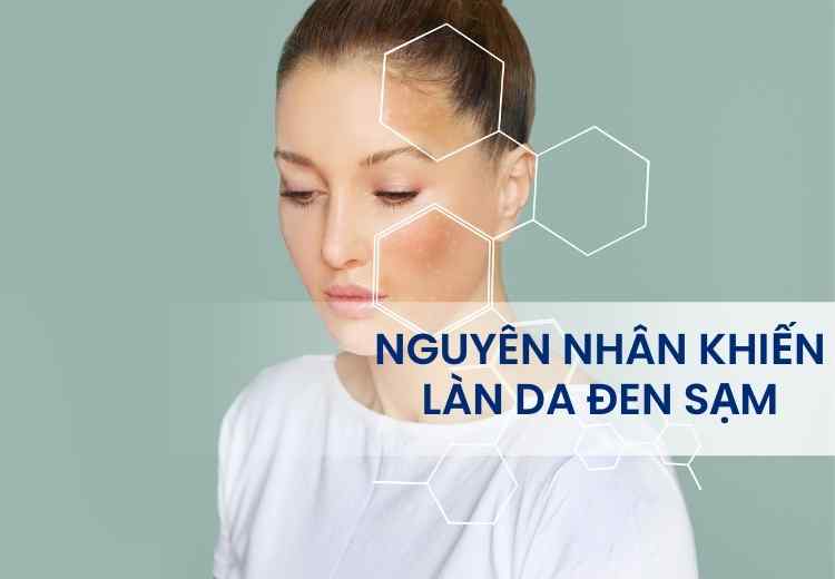 NGUYÊN NHÂN KHIẾN LÀN DA ĐEN SẠM