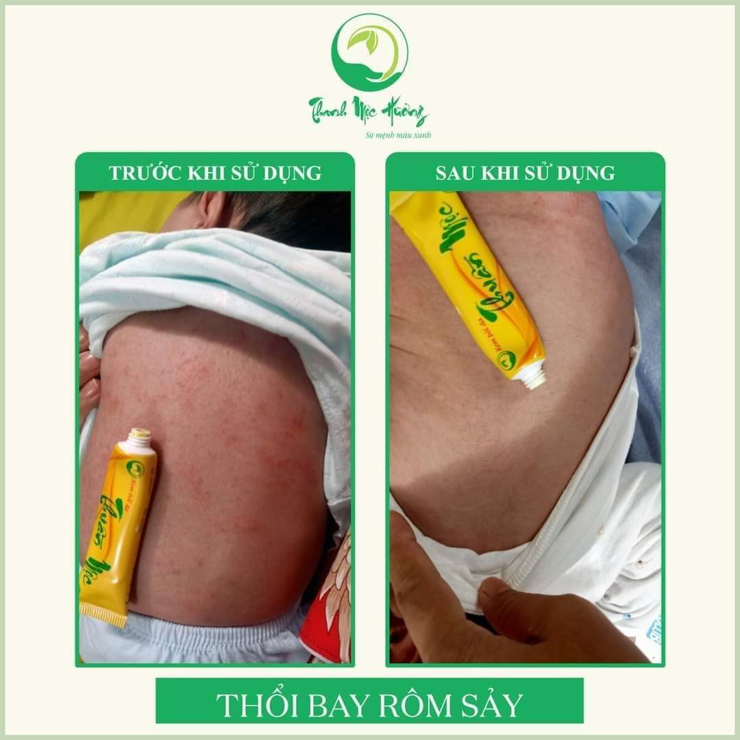 Kem bôi da thuần mộc (16g)