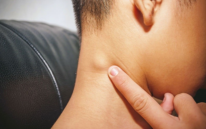 Tai bị nổi hạch