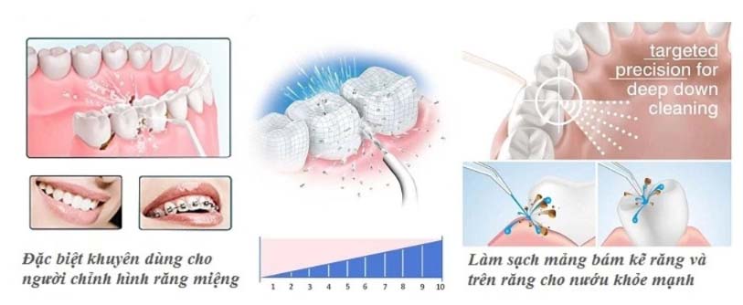 Máy tăm nước panasonic EW 1211W phù hợp với người viêm lợi, niềng răng