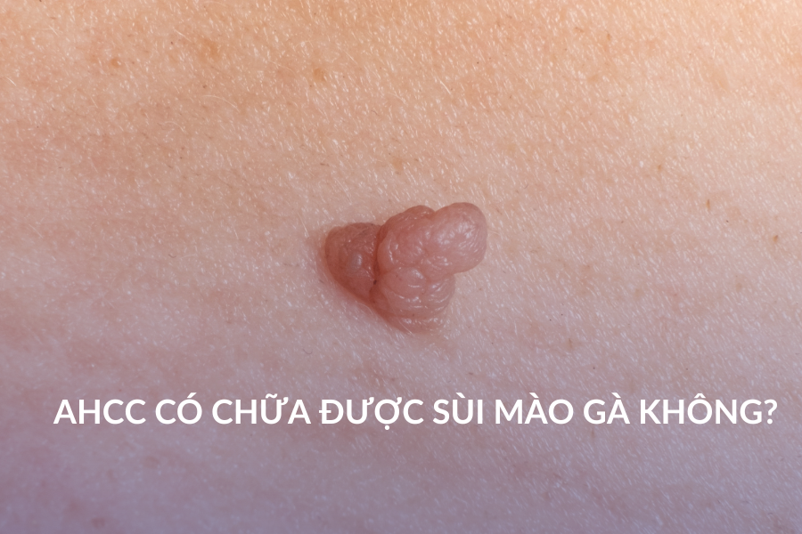 AHCC có chữa được sùi mào gà không?