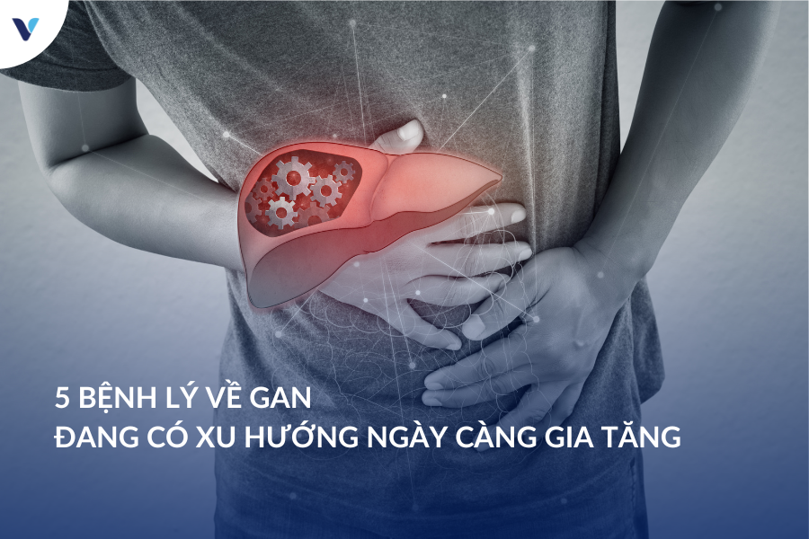 5 bệnh lý về gan đang có xu hướng ngày càng gia tăng