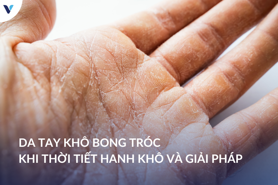 Da tay khô bong tróc khi thời tiết hanh khô và giải pháp