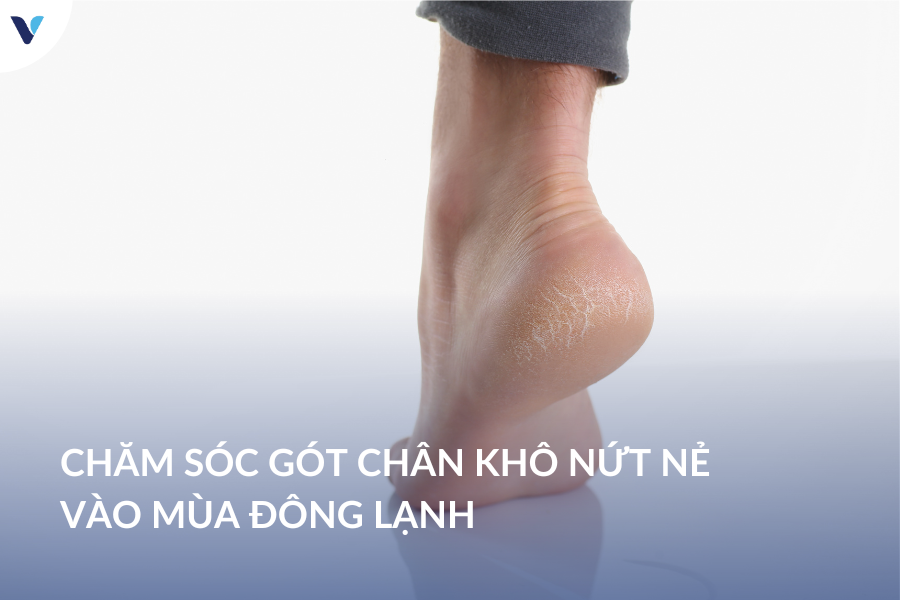 Chăm sóc gót chân khô nứt nẻ vào mùa đông lạnh