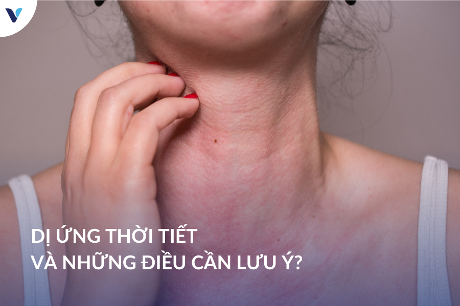 Dị ứng thời tiết và những điều cần lưu ý?