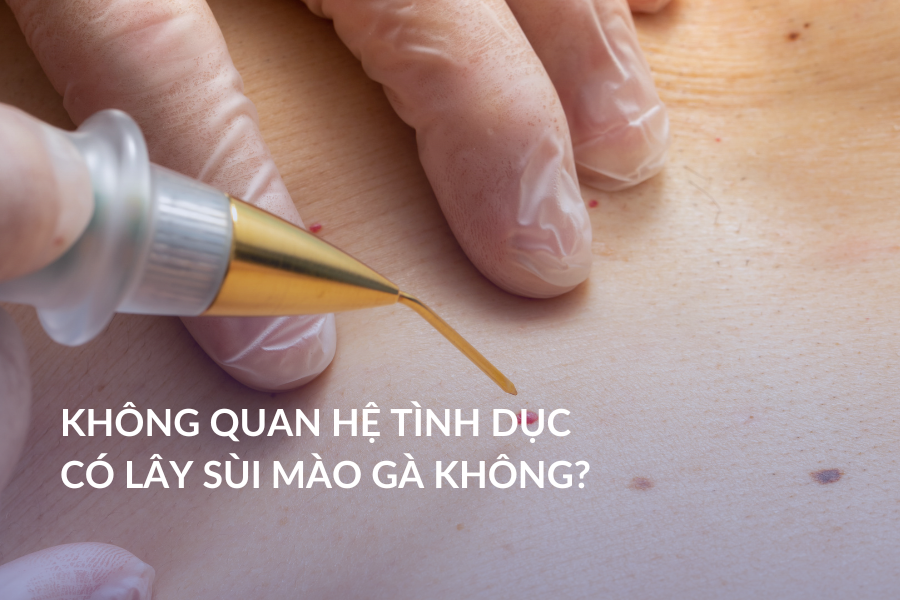 Không quan hệ tình dục có lây sùi mào gà không?