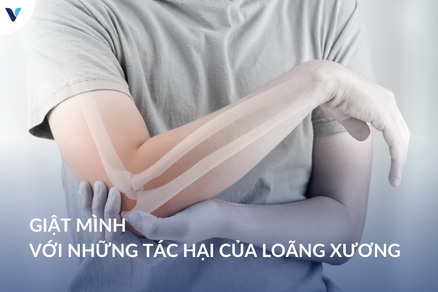 Giật mình với những tác hại của loãng xương