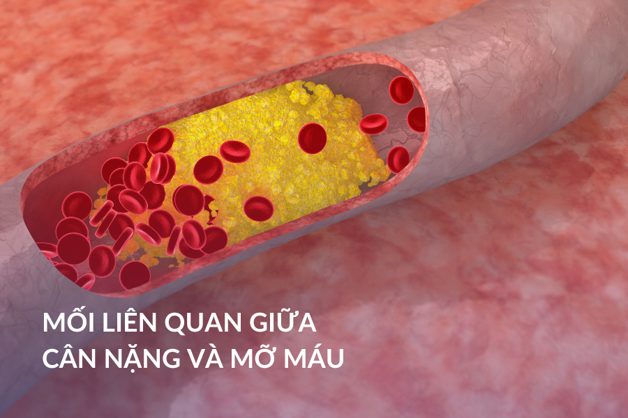 Mối liên quan giữa cân nặng và mỡ máu