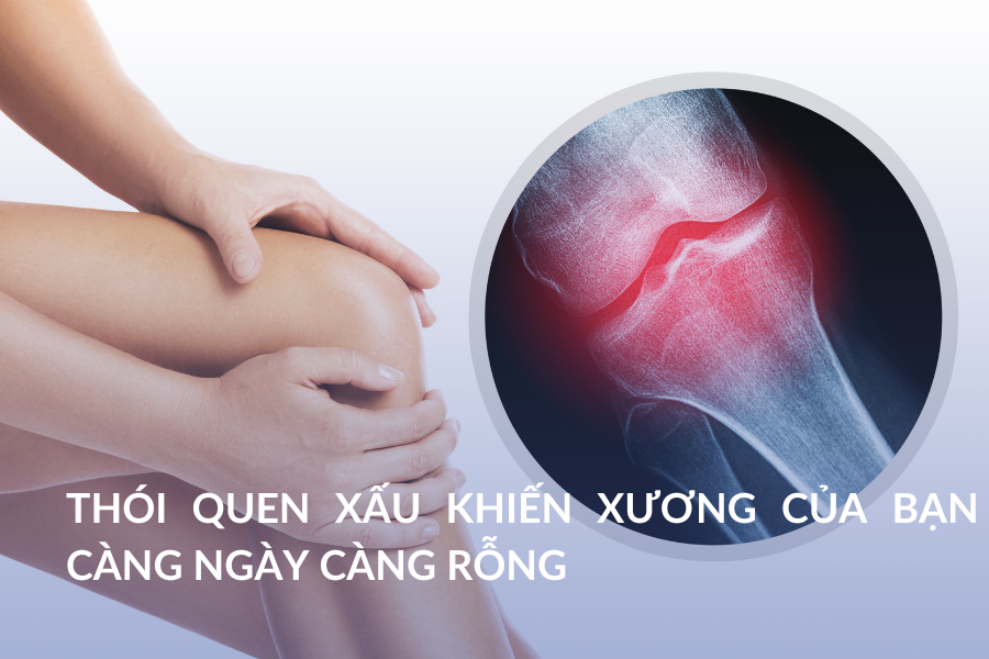 Thói quen xấu khiến xương của bạn càng ngày càng rỗng