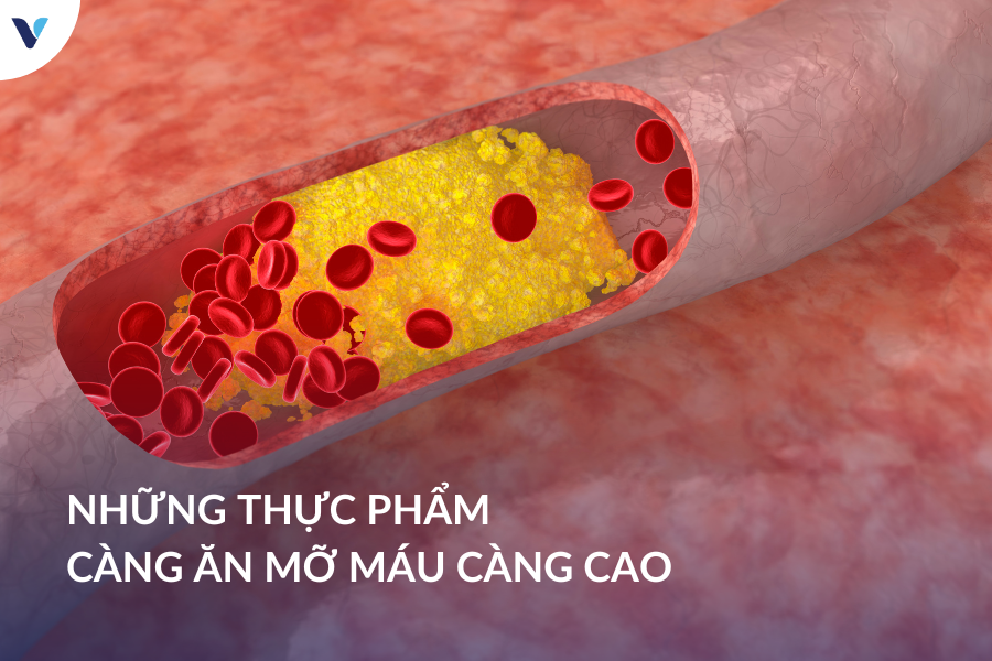 Tổng hợp những thực phẩm càng ăn mỡ máu càng cao