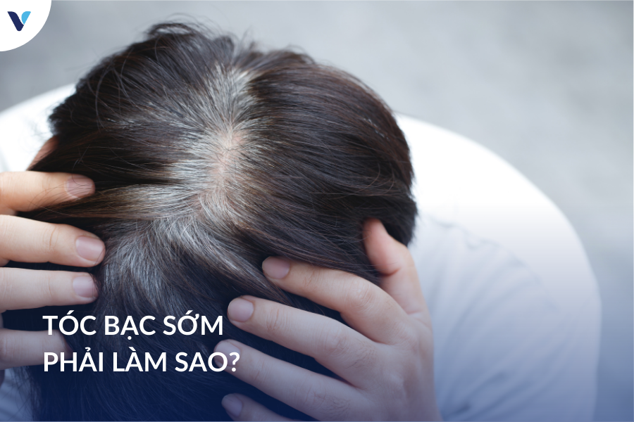 Tóc bạc sớm phải làm sao?