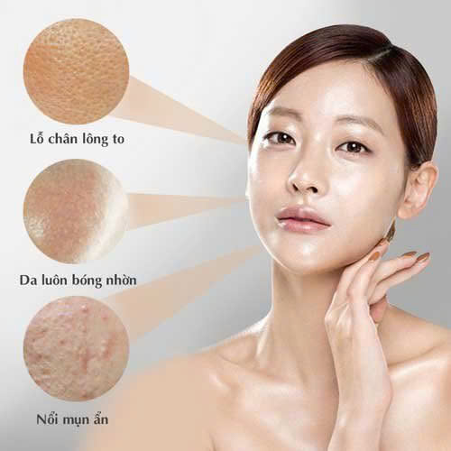 Quy trình chăm sóc da dầu mụn