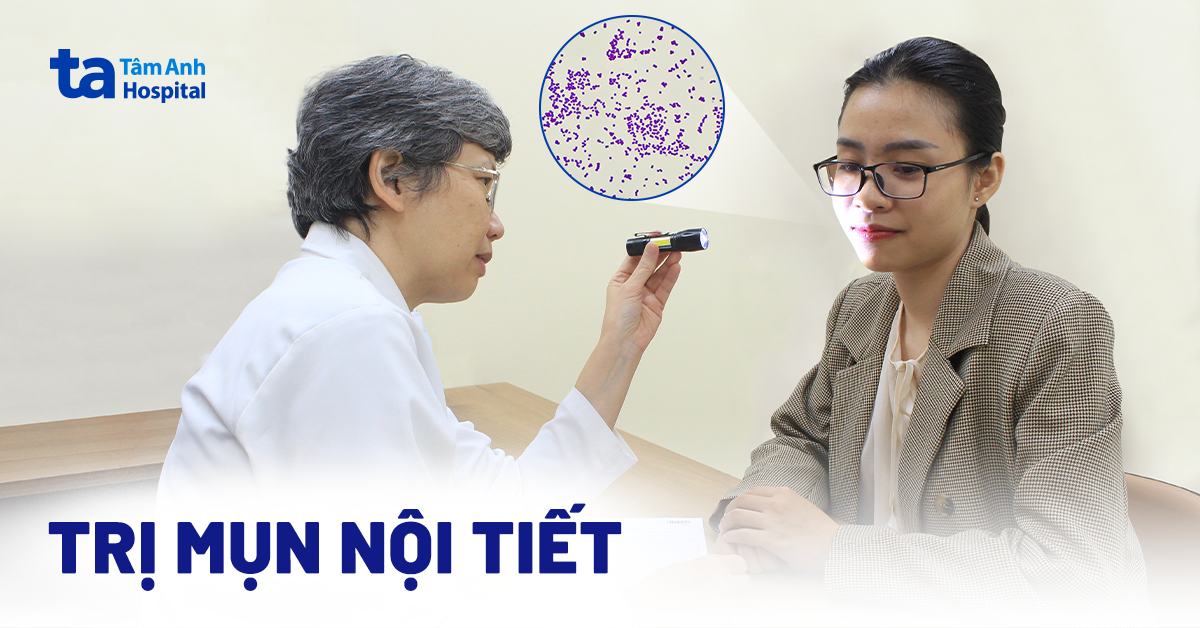 Quy trình trị mụn và nội tiết tố