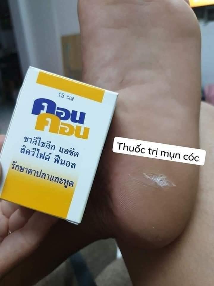 Thuốc đặc trị mụn cóc, mụn cơm Con Con Thái Lan