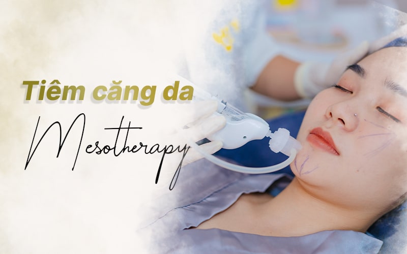 Tiêm căng da Mesotherapy và những lợi ích tuyệt vời 