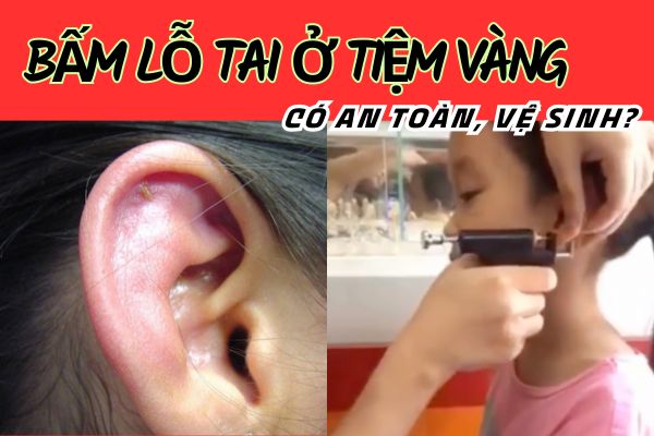 Bấm lỗ tai ở tiệm vàng có an toàn không?