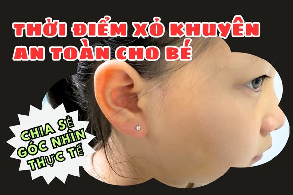 Bé mấy tháng bấm lỗ tai an toàn? Chia sẻ góc nhìn thực tế