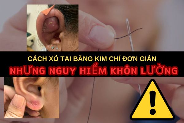 Cách xỏ khuyên tai bằng kim chỉ đơn giản nhưng nguy hiểm khôn lường