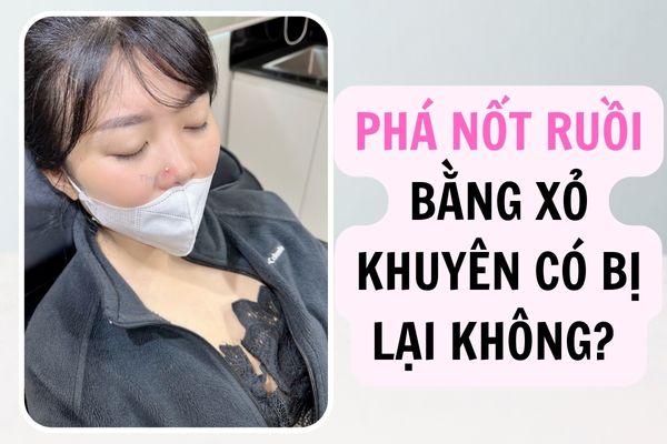 Phá nốt ruồi phong thuỷ bằng cách xỏ khuyên mũi có thể bạn chưa biết
