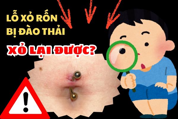 Xỏ khuyên rốn bị đào thải có xỏ lại được không?
