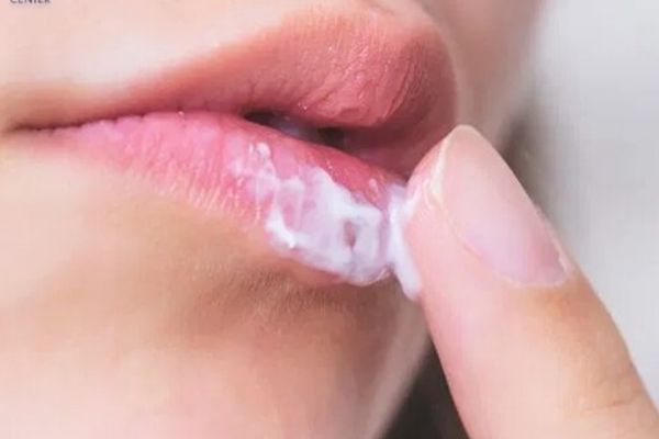 Xỏ môi có đau không? Mẹo vặt giúp giảm đau trước khi xỏ