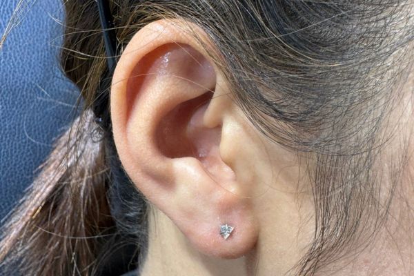 Ảnh xỏ Lobe