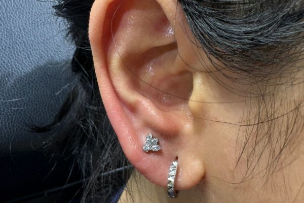 Ảnh xỏ Lobe