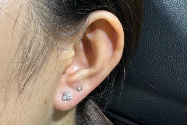 Ảnh xỏ Lobe