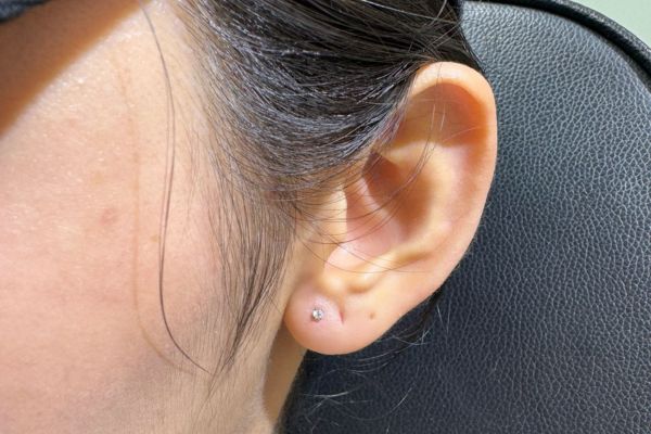 Ảnh xỏ Lobe