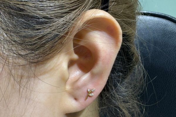 Ảnh xỏ Lobe