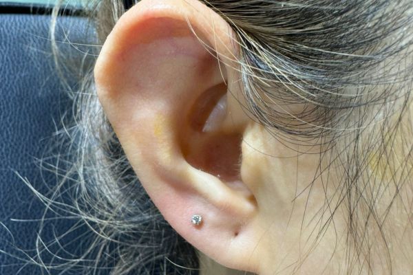 Ảnh xỏ Lobe