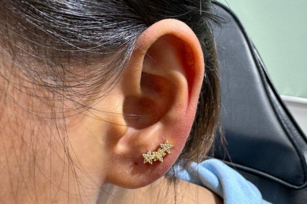 Ảnh xỏ Lobe