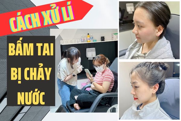 Bấm khuyên tai bị chảy nước
