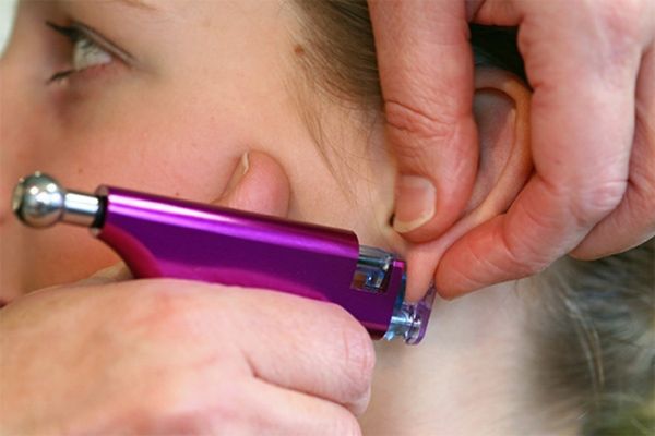 Bấm lỗ tai 1 tuần bị sưng và cách sơ cứu tại nhà an toàn
