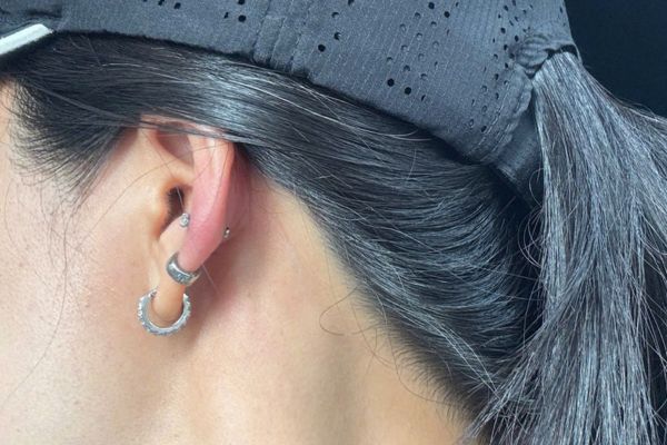 lỗ xỏ bị sưng đỏ không nên tự ý thay tháo khuyên khi chưa có chỉ định 