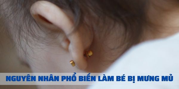 Bấm lỗ tai cho bé bị mưng mủ phải làm sao?