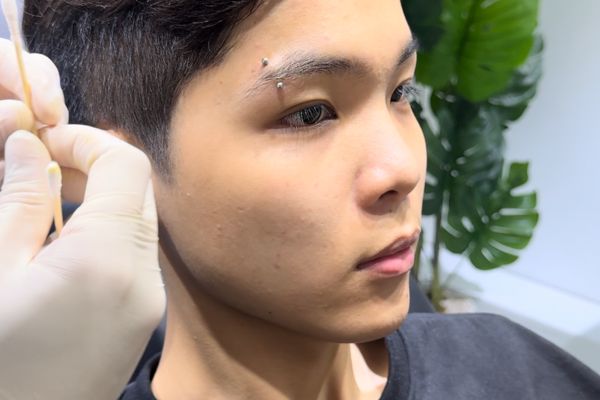 Bấm lỗ tai chuẩn y khoa ở đâu?