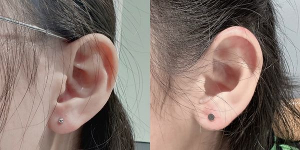 Bấm lỗ tai không đau cho bé