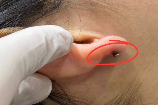 không vệ sinh là nguyên nhân gây ra tình trạng bump lỗ xỏ