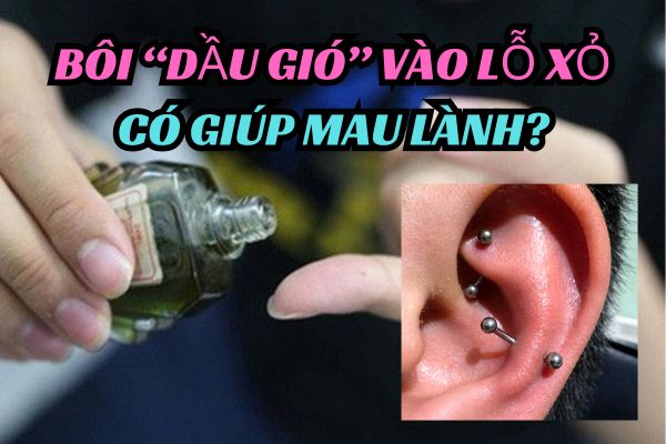 Bôi dầu gió xanh vào lỗ xỏ khuyên được không?