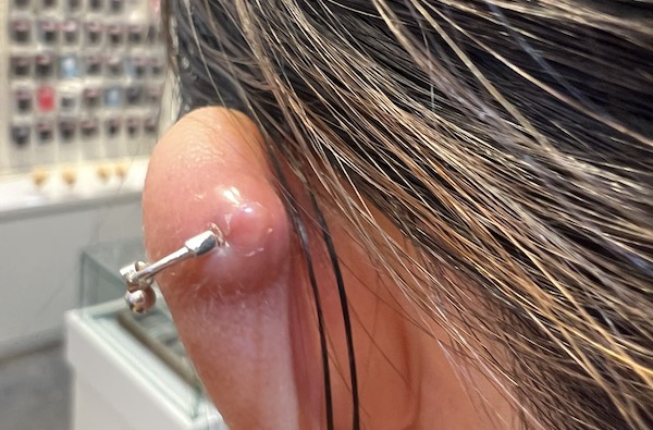 Bôi dầu gió xanh vào lỗ xỏ khuyên được không?