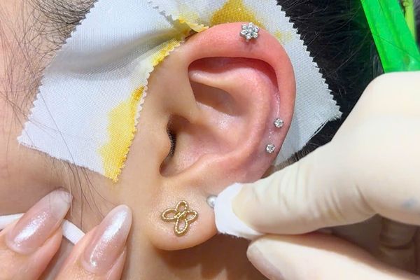 Hết đau vẫn cần "kỷ luật"! Cách chăm sóc lỗ xỏ tránh sẹo lồi