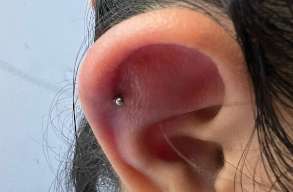 Cách để lỗ xỏ khuyên bị nhiễm trùng không xảy ra