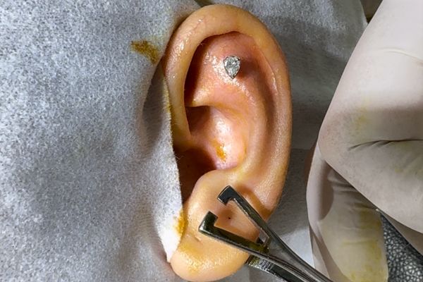 Cách để lỗ xỏ khuyên bị nhiễm trùng không xảy ra