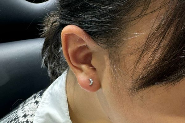 Cách giữ lỗ tai không bị bít 